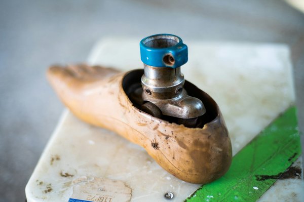 Chaussette orthopédique : votre allié pour des pieds en santé